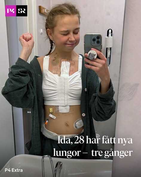 Mette-Marits tuffa kamp har bara börjat – transplantationspatient berättar sanningen