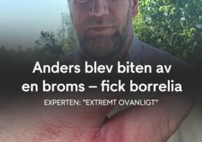 Anders blev biten av en broms – fick borrelia